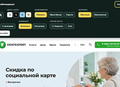 DentExpert — сайт стоматологической клиники (sitexpert.dent) - рішення на Бітрікс