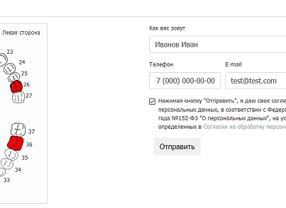 Калькулятор імплантатів (inkoder.implantcalc) - рішення на Бітрікс