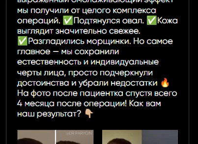 44labs: Пости з ВК (s44labs.vkposts) - рішення на Бітрікс